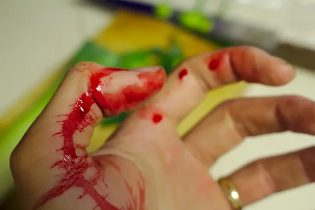 accident, bleed, bleeding finger, chopping, chopping board, cut, cutting board, emergency, finger, health care, health-care, hurt, injured, injury, kitchen, knife, medical, pain, red, slicing, thumb, wound, brown health, brown kitchen, brown medical, brown pain, brown emergency, brown blood, brown care, brown board